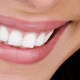 Woman_Smiling_Teeth_Whitening