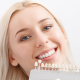 Cosmetic Dentistry